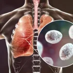 منظمة الصحة العالمية تحذر: أزمة سوء تغذية حادة تهدد حياة سكان غزة