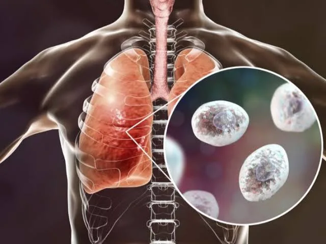 IMG 9746 - CJ العربية