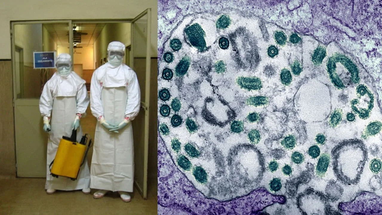 فيروس الماربوغ في اثيوبيا