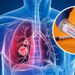 زلزال في منظمة الصحة العالمية: الولايات المتحدة تنسحب رسمياً وبداية عصر “التنبؤ الطبي” بالذكاء الاصطناعي